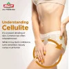 Jolly Fat Go Anti Cellulite Massage Oil (110ml, Pack of 5)