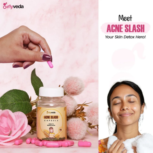 Girlyveda Acne  Capsules + Just Hair Oil (60cap + 100ml Oil) (1Pack)