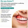 Vedistry Gumcare Gel (50g)