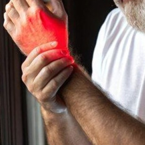 Arthritis & Rheumatism